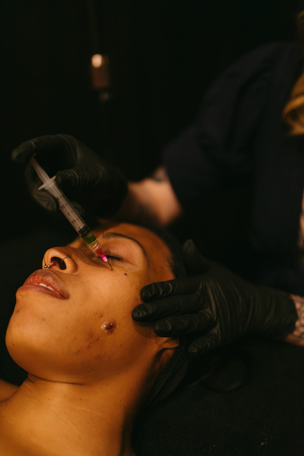 BioRePeel at The Skin Sanctum in Denver CO