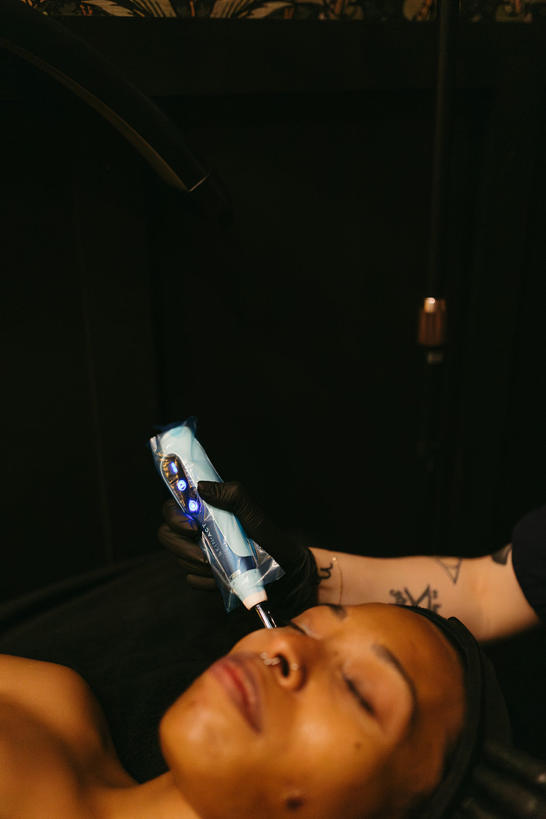 Microneedling in denver