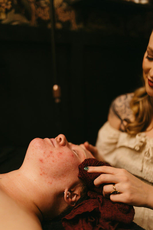 Acne treatment at the skin sanctum in Denver co