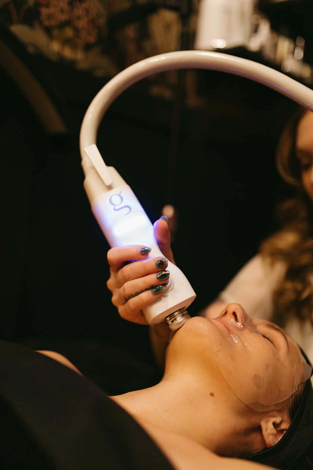 Chemical peel and Cryo treatment in Denver CO